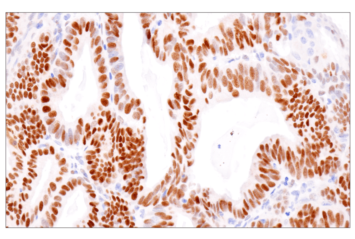 Immunohistochemistry Image 6: Estrogen Receptor alpha (D8H8) Rabbit Monoclonal Antibody