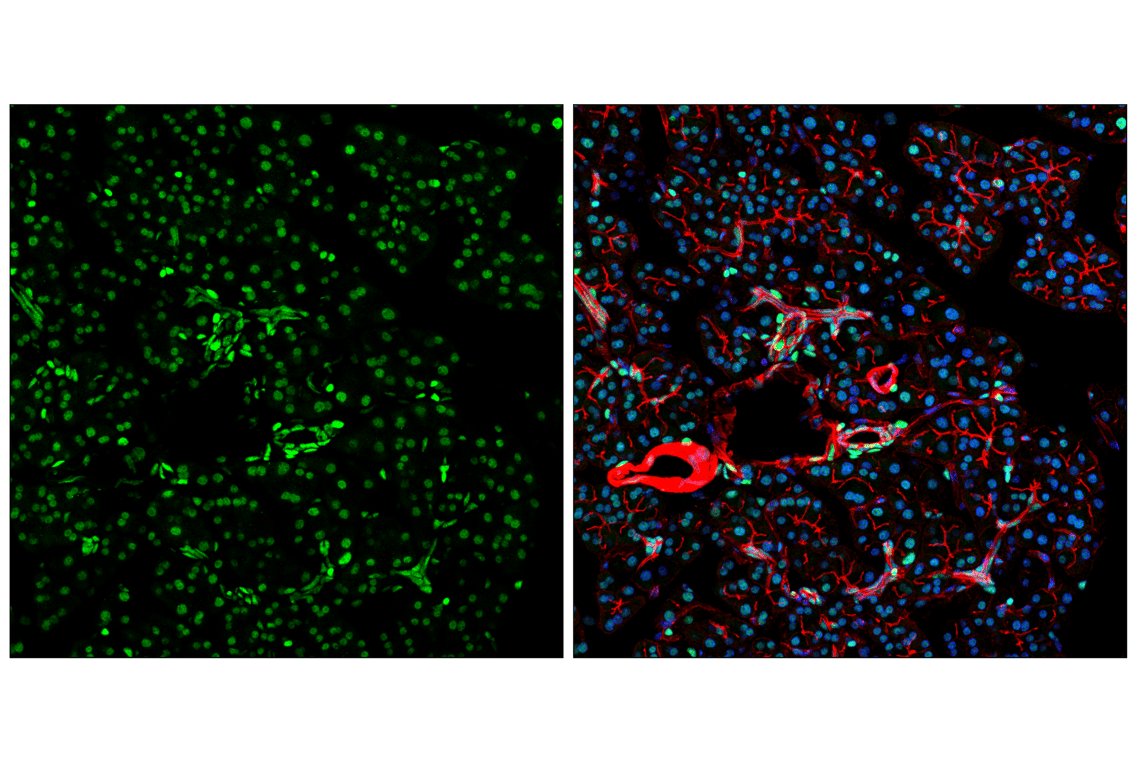 Immunofluorescence Image 3: HP1 alpha (F3K7M) Rabbit Monoclonal Antibody