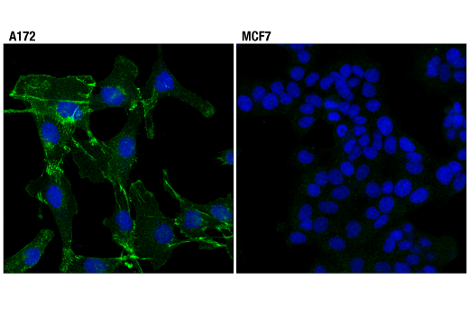 Immunofluorescence Image 1: N-Cadherin (D4R1H) Rabbit Monoclonal Antibody (BSA and Azide Free)