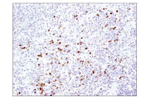 undefined Image 24: TGF-beta Fibrosis Pathway Antibody Sampler Kit
