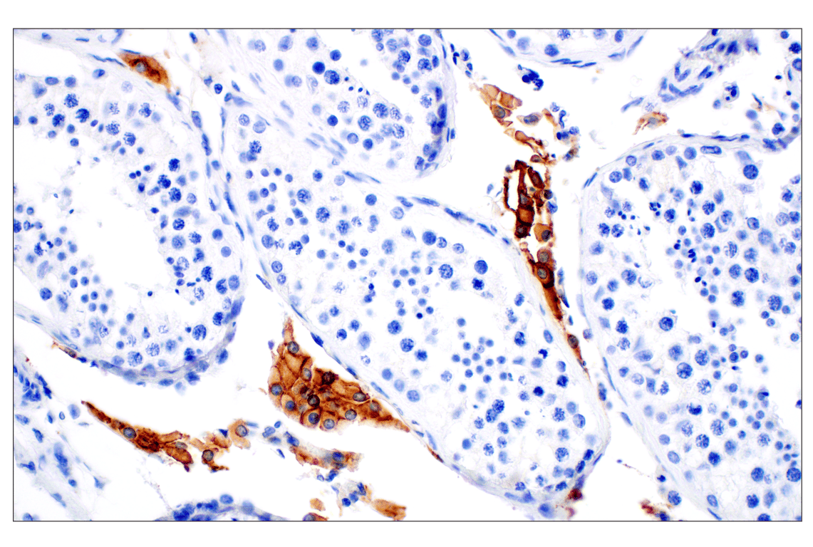 Immunohistochemistry Image 4: SCARB1 (E9H4F) Rabbit Monoclonal Antibody