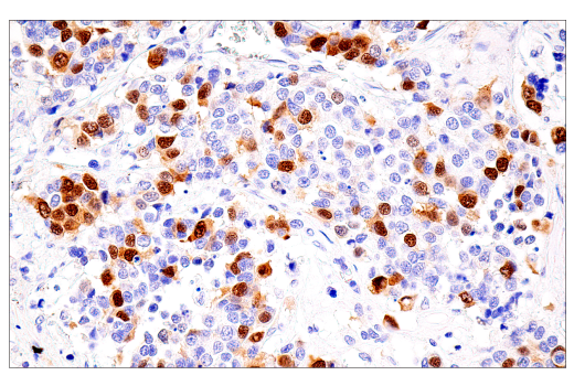 Immunohistochemistry Image 7: Cyclin A2 (E6D1J) XP<sup>®</sup> Rabbit mAb (BSA and Azide Free)