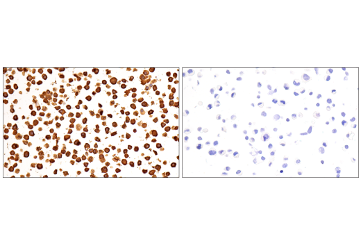 undefined Image 46: Xenophagy Antibody Sampler Kit