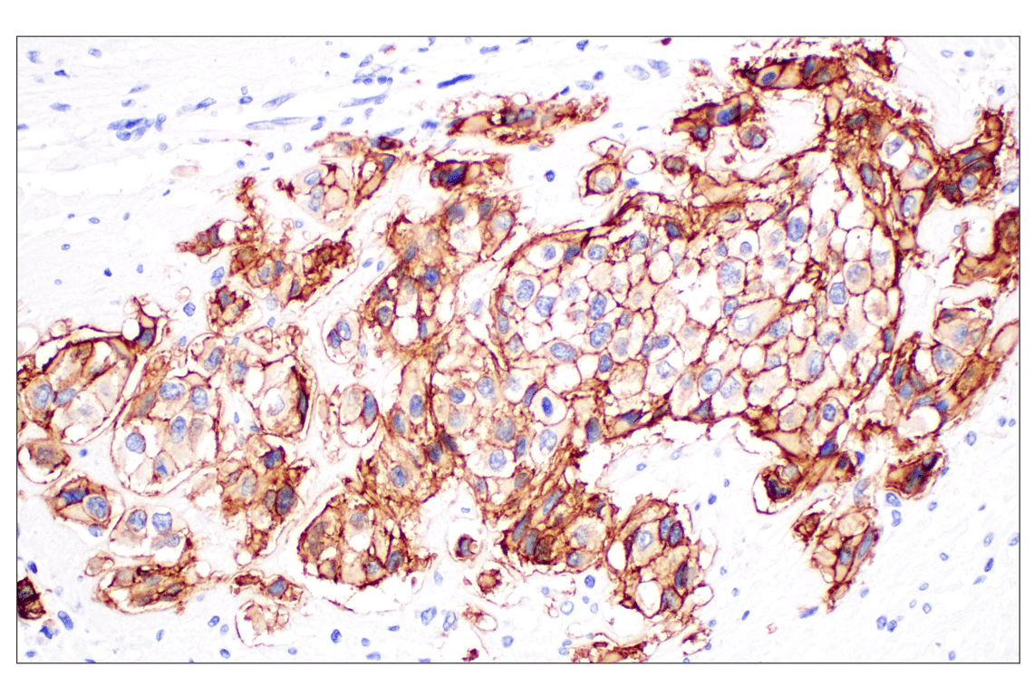 Immunohistochemistry Image 5: TACSTD2/TROP2 (F4W4J) Rabbit Monoclonal Antibody (BSA and Azide Free)