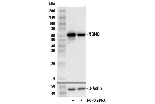 Western Blotting Image 1: NONO (E8Q3E) Rabbit mAb