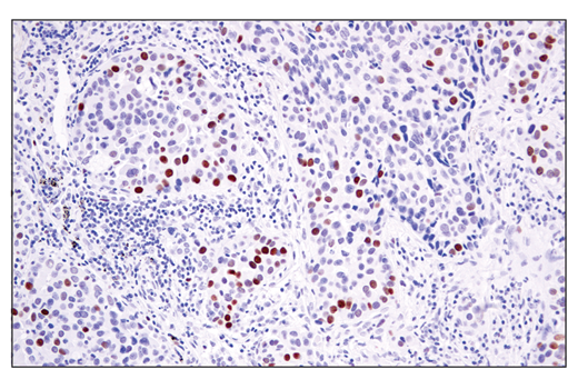 Immunohistochemistry Image 3: ATAD2 (E8Y2K) Rabbit Monoclonal Antibody