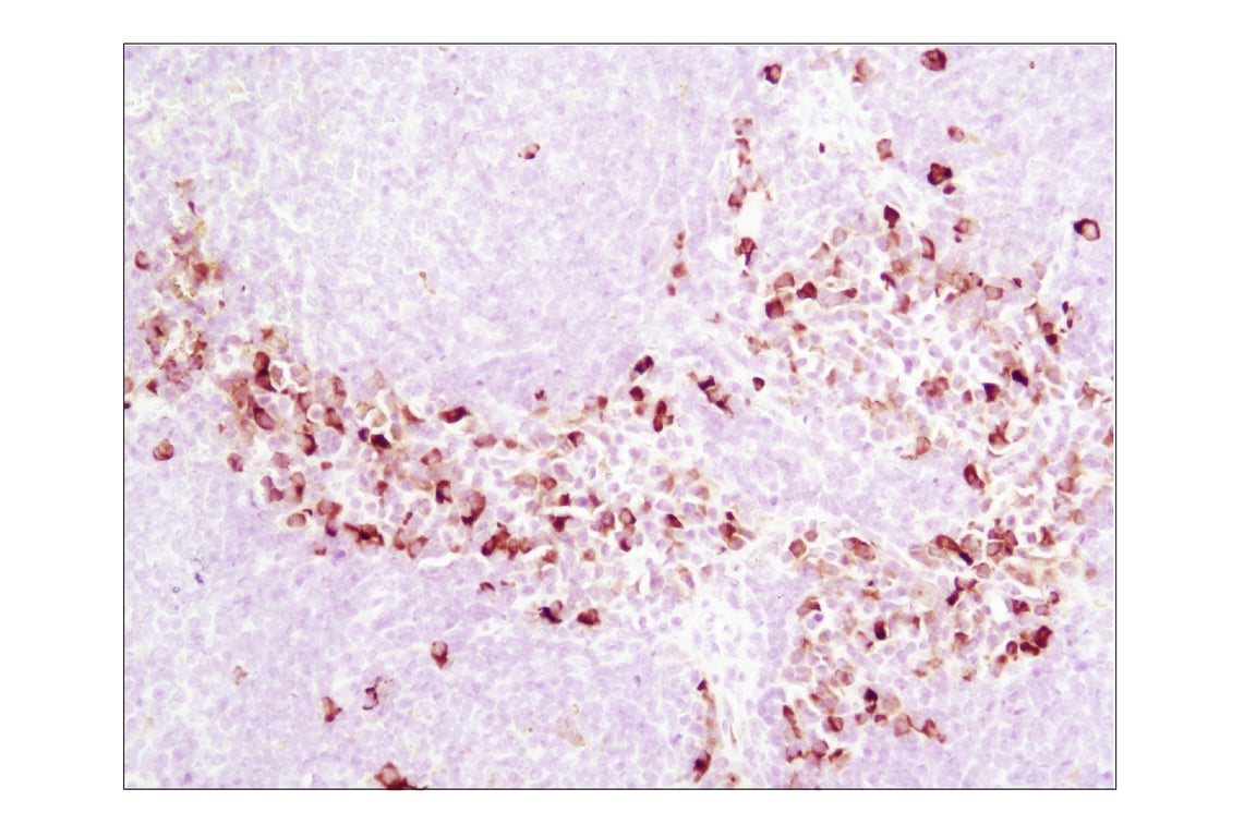 Immunohistochemistry Image 3: Phospho-S6 Ribosomal Protein (Ser235/236) (D57.2.2E) Rabbit Monoclonal Antibody (BSA and Azide Free)