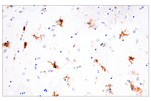 Immunohistochemistry Image 6: FcR gamma (E6Y1A) Rabbit Monoclonal Antibody