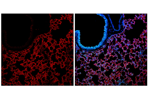 Immunofluorescence Image 1: CD36 (E8B7S) Rabbit Monoclonal Antibody (BSA and Azide Free)