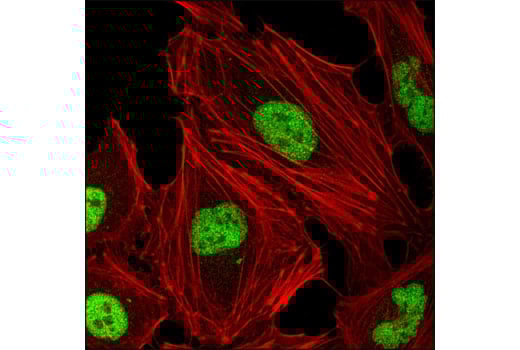 Jumonji Family Antibody Sampler Kit | Cell Signaling Technology