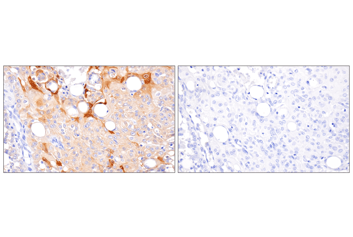 Immunohistochemistry Image 8: APOBEC3A (UMN-13) Rabbit Monoclonal Antibody