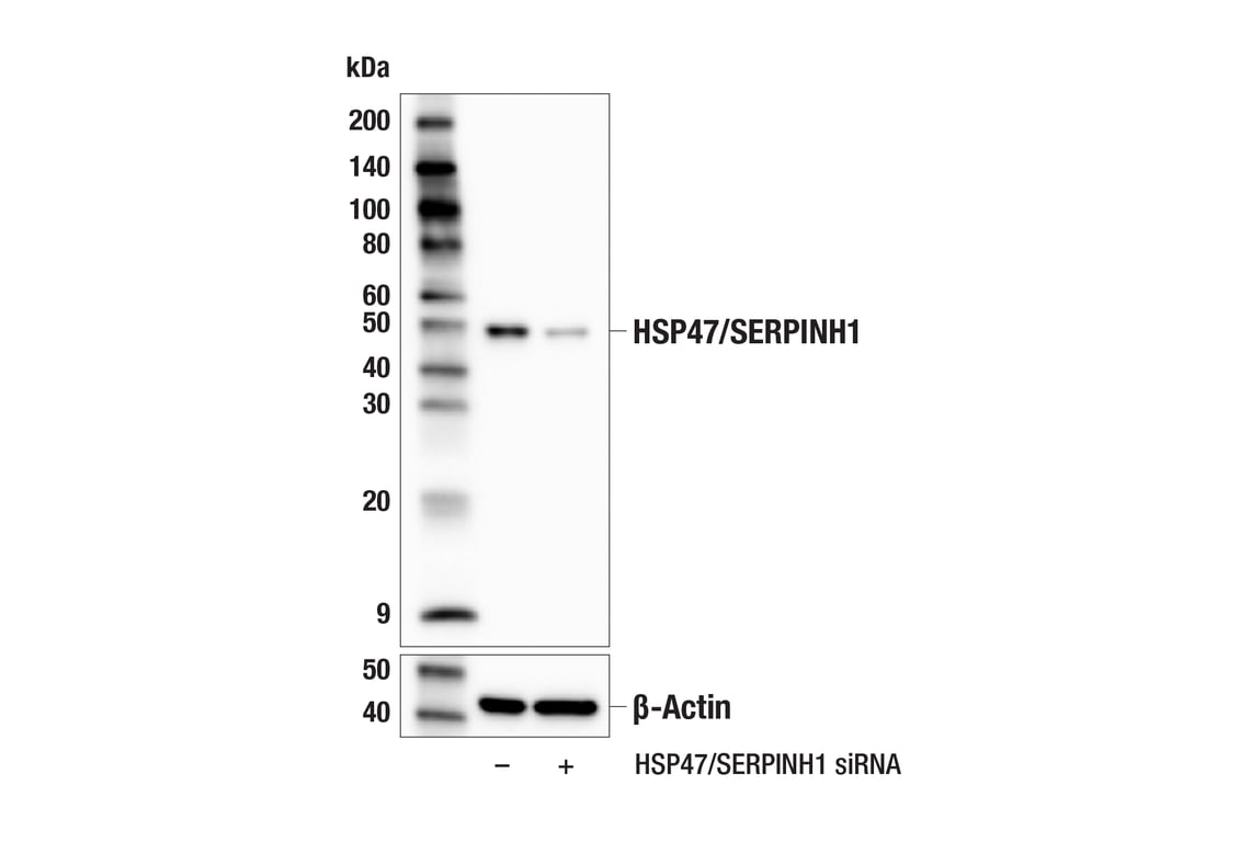 Western Blotting Image 2: HSP47/SERPINH1 (E4A8P) Rabbit Monoclonal Antibody