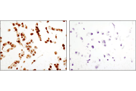 Immunohistochemistry Image 2: GATA-3 (D13C9) Rabbit Monoclonal Antibody (BSA and Azide Free)