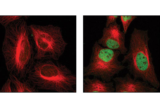 Immunofluorescence Image 1: Phospho-Stat3 (Tyr705) (M9C6) Mouse Monoclonal Antibody (BSA and Azide Free)