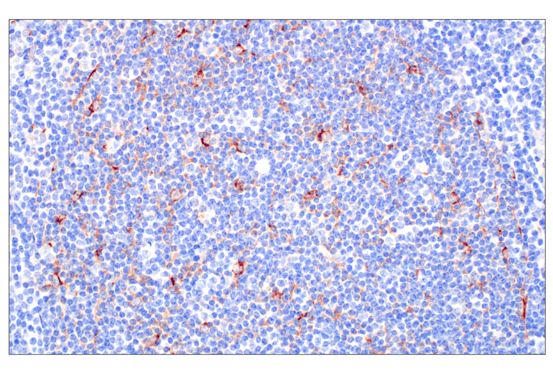 Immunohistochemistry Image 4: CXCL13 (F6A4R) Rabbit Monoclonal Antibody