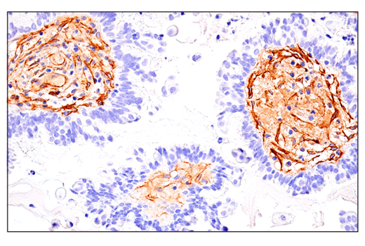 Immunohistochemistry Image 3: CD248 (E9Z7O) XP<sup>®</sup> Rabbit mAb (BSA and Azide Free)