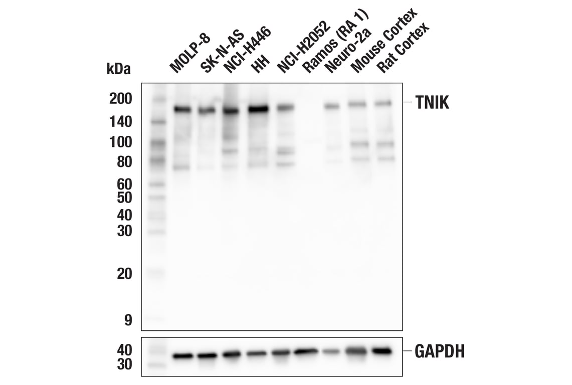 Western Blotting Image 2: TNIK Antibody
