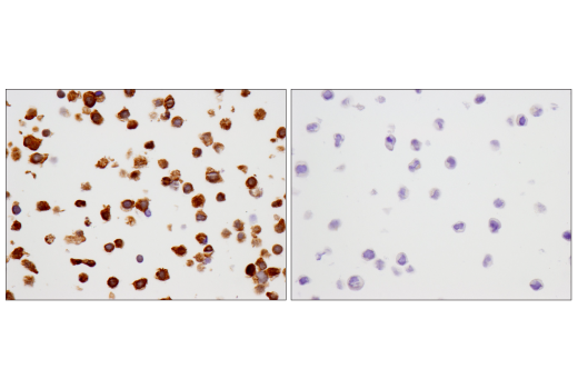 Immunohistochemistry Image 4: SMAD4 (D3R4N) Rabbit Monoclonal Antibody (BSA and Azide Free)