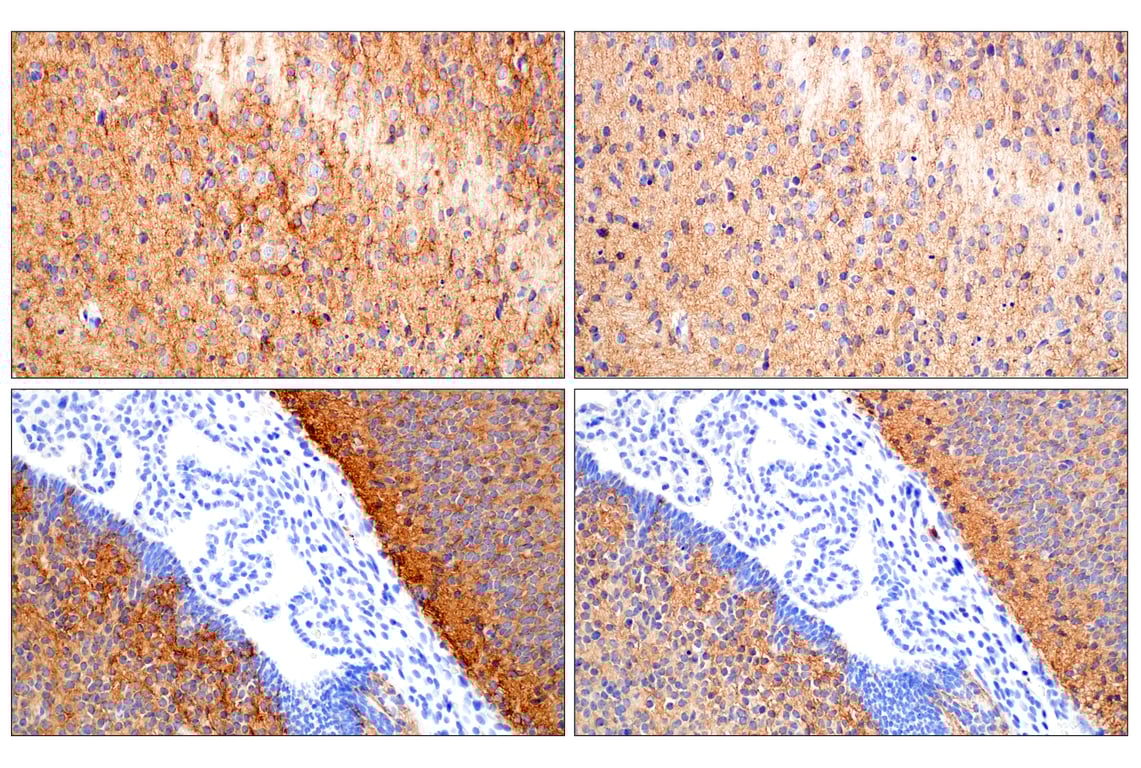 Immunohistochemistry Image 5: Doublecortin (E3S7L) Rabbit Monoclonal Antibody