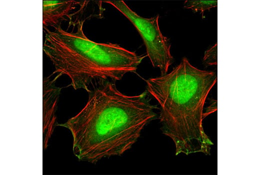 Immunofluorescence Image 1: Cofilin (D3F9) XP<sup>®</sup> Rabbit mAb