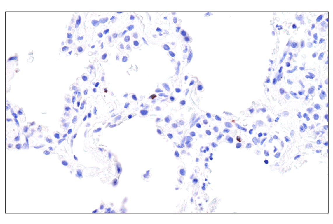 Immunohistochemistry Image 6: Perforin (IHC646) Mouse Monoclonal Antibody