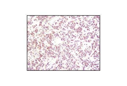 Immunohistochemistry Image 1: p35/25 (C64B10) Rabbit Monoclonal Antibody (BSA and Azide Free)