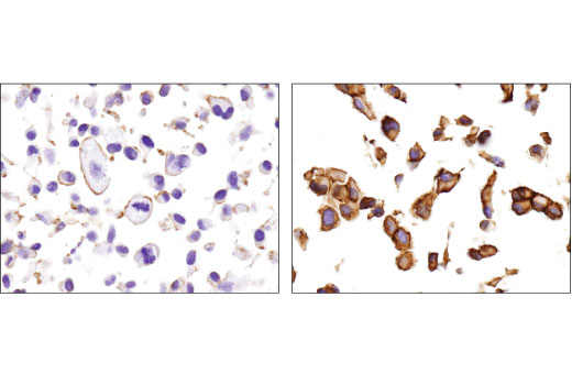 Immunohistochemistry Image 3: MRP1/ABCC1 (D5C1X) Rabbit Monoclonal Antibody (BSA and Azide Free)