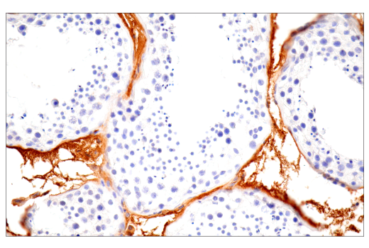 Immunohistochemistry Image 10: alpha-2-Macroglobulin (E6N7X) Rabbit Monoclonal Antibody