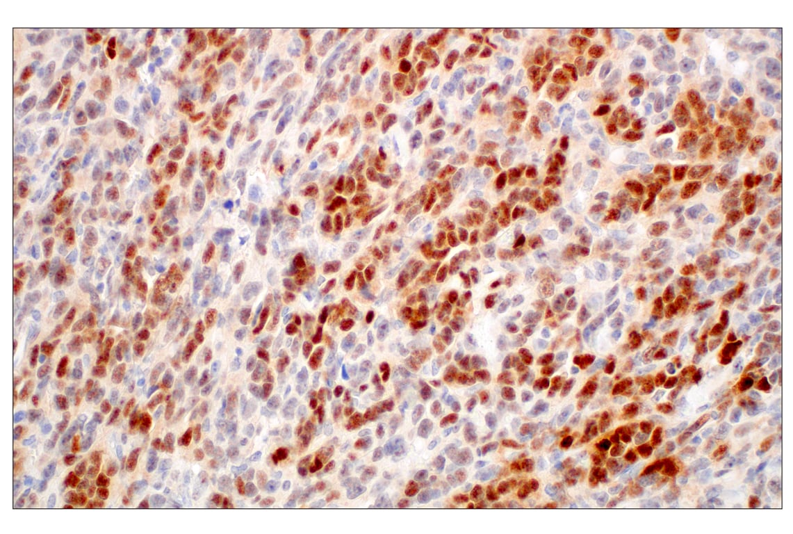 Immunohistochemistry Image 10: ARK5 (E4T2A) Rabbit Monoclonal Antibody