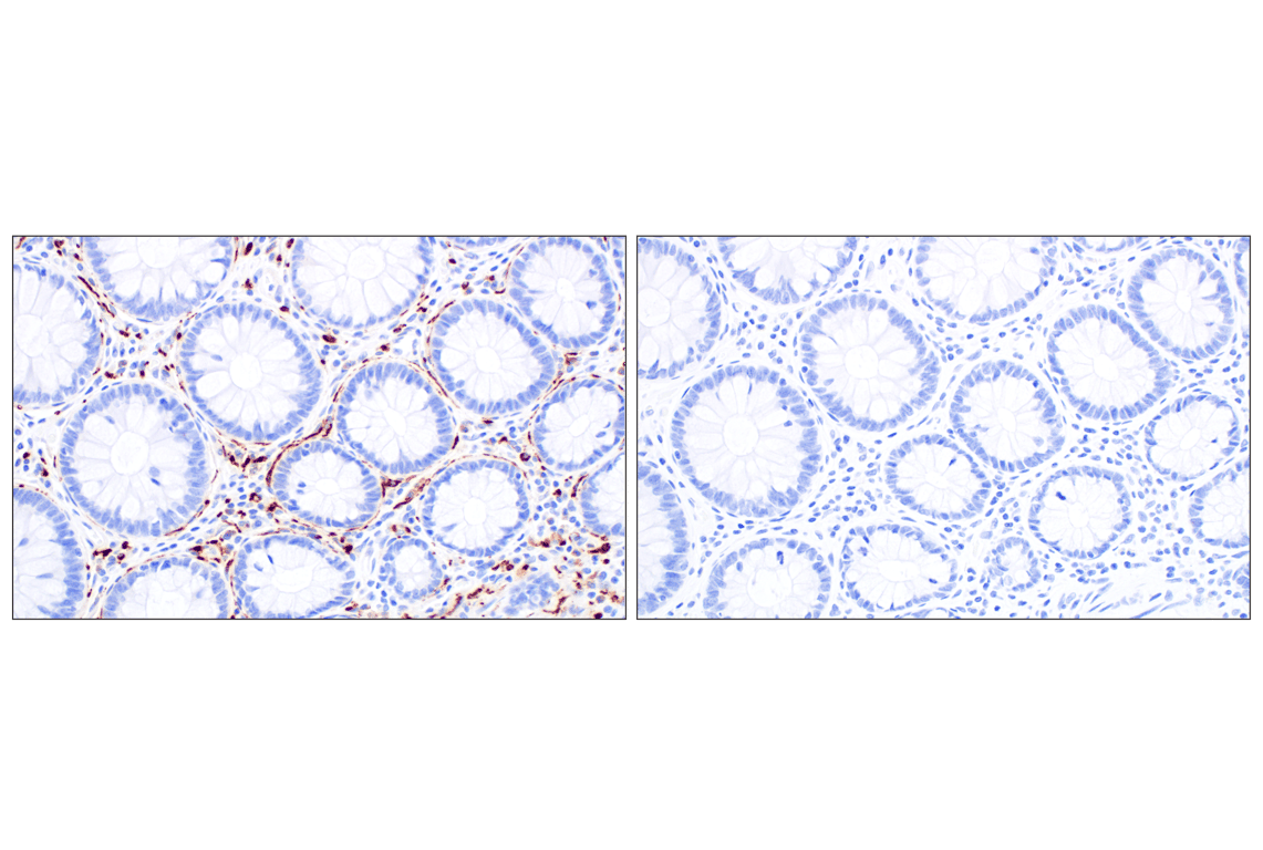 Immunohistochemistry Image 9: GAP43 (E6L2W) Mouse Monoclonal Antibody