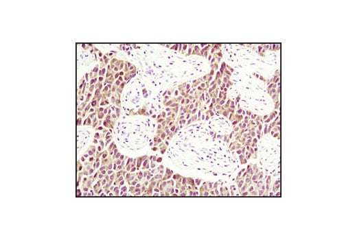 Immunohistochemistry Image 1: PDCD4 (D29C6) Rabbit Monoclonal Antibody