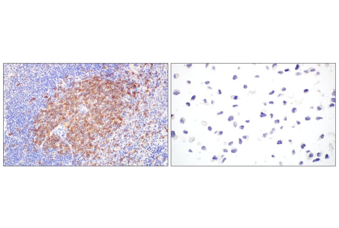 Immunohistochemistry Image 7: CD6 (E9Q1V) Rabbit Monoclonal Antibody