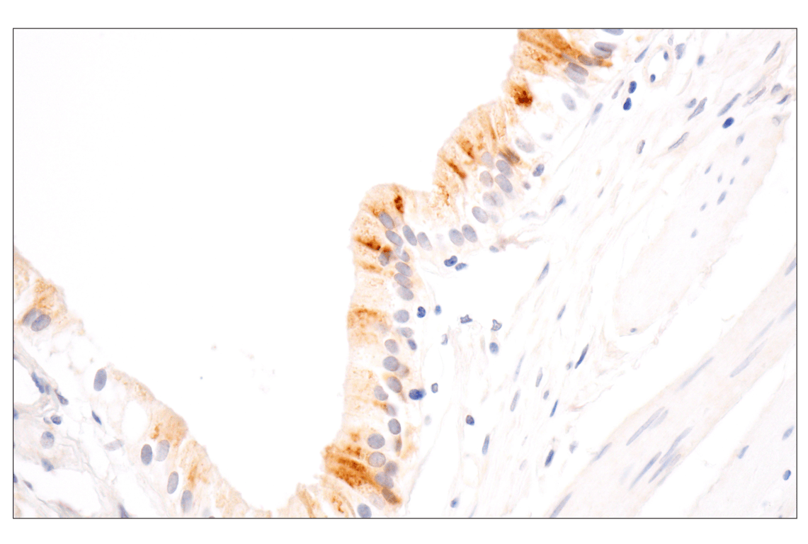 Immunohistochemistry Image 4: MMP-1 (E9S9N) Rabbit Monoclonal Antibody