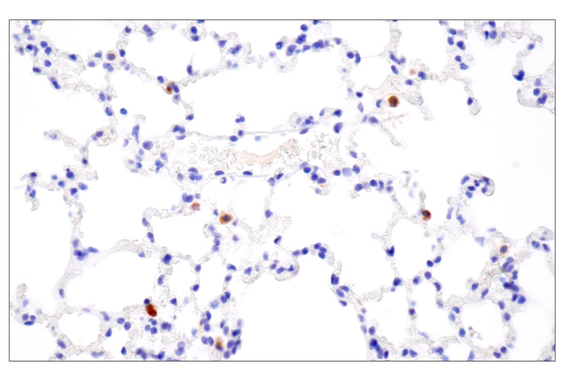 Immunohistochemistry Image 6: Cathepsin K (E7U5N) Rabbit Monoclonal Antibody