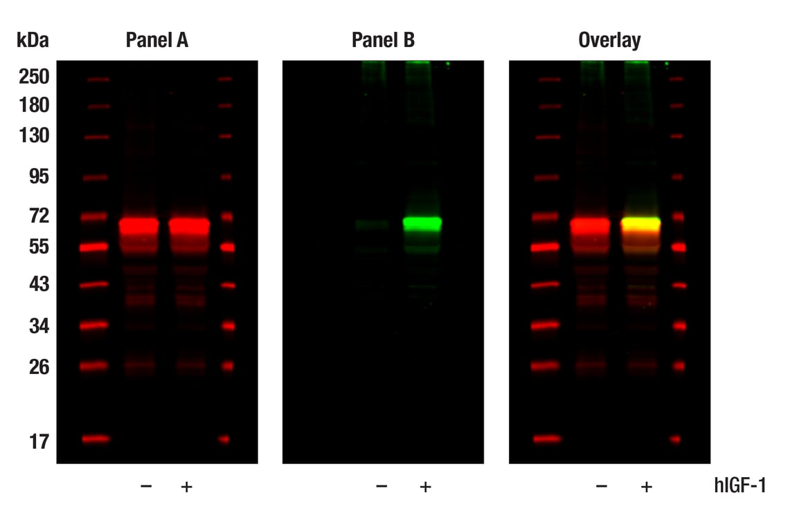 Western Blotting Image 1: Phospho-Akt (Thr308) (D25E6) Rabbit Monoclonal Antibody