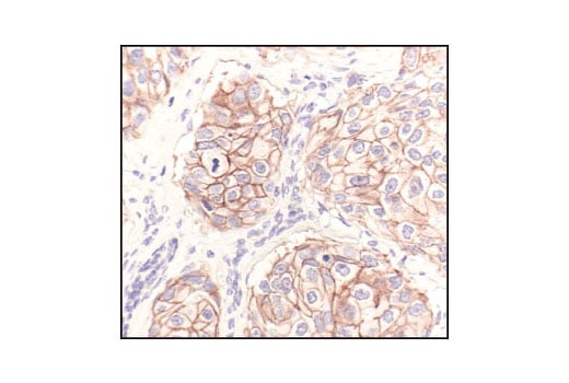 Immunohistochemistry Image 1: HER2/ErbB2 (29D8) Rabbit Monoclonal Antibody