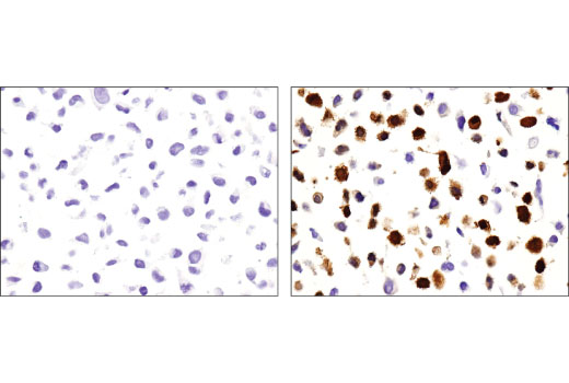 H. hepaticus|カテゴリーC 画像|微生物|ICLAS Monitoring Center
