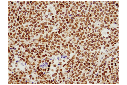 Immunohistochemistry Image 2: Exportin-1/CRM1 (D6V7N) Rabbit Monoclonal Antibody