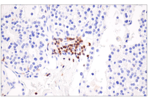 Immunohistochemistry Image 1: SLAMF6/CD352 (E3H1E) Rabbit Monoclonal Antibody (BSA and Azide Free)
