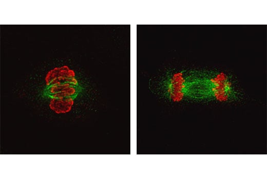 Immunofluorescence Image 2: alpha/beta-Tubulin Antibody