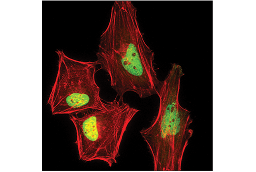 TDP43 (D9R3L) Rabbit Monoclonal Antibody | Cell Signaling Technology