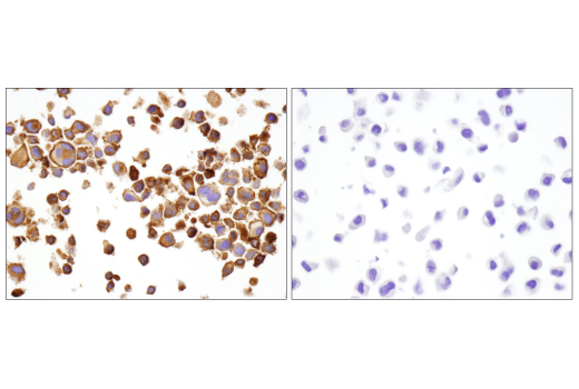 Immunohistochemistry Image 6: LAG3 (D2G4O) Rabbit Monoclonal Antibody (BSA and Azide Free)