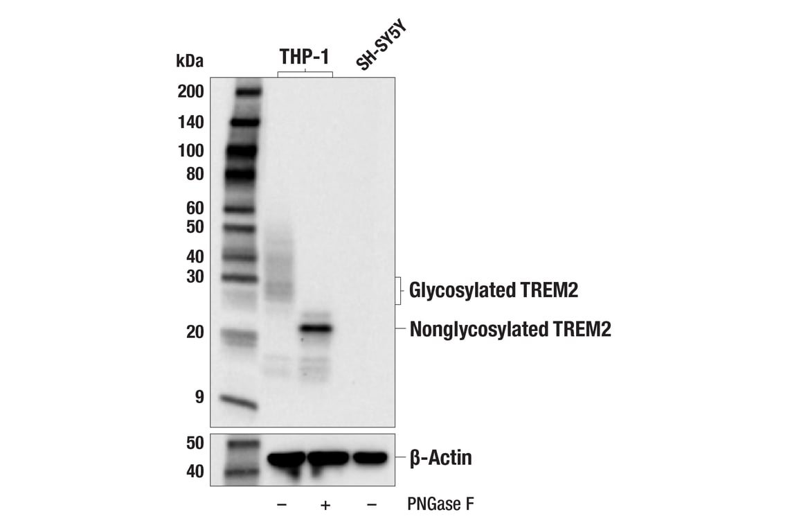 Western Blotting Image 2: TREM2 (E4F5G) Mouse Monoclonal Antibody