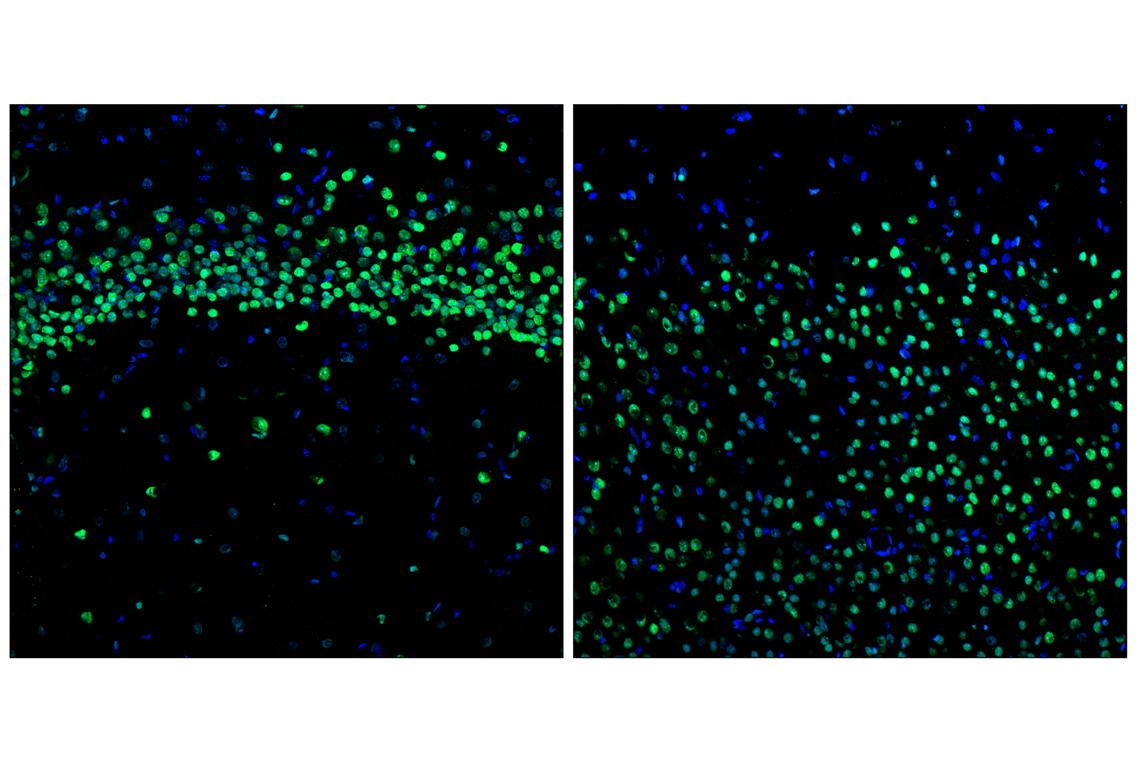 Immunofluorescence Image 1: HP1 alpha (F3K7M) Rabbit Monoclonal Antibody