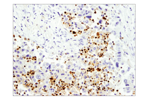 Immunohistochemistry Image 2: Myeloperoxidase (E1E7I) Rabbit Monoclonal Antibody (BSA and Azide Free)