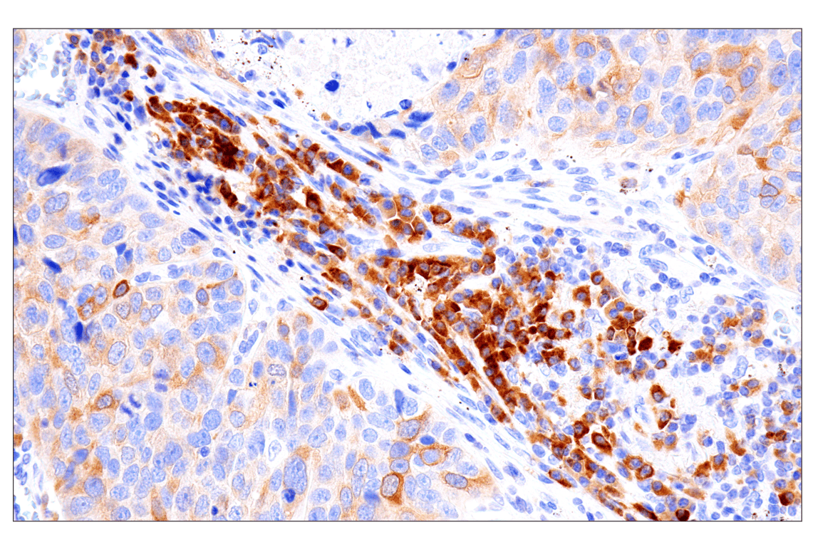 Immunohistochemistry Image 3: Asparagine Synthetase (E6C2C) Rabbit Monoclonal Antibody (BSA and Azide Free)