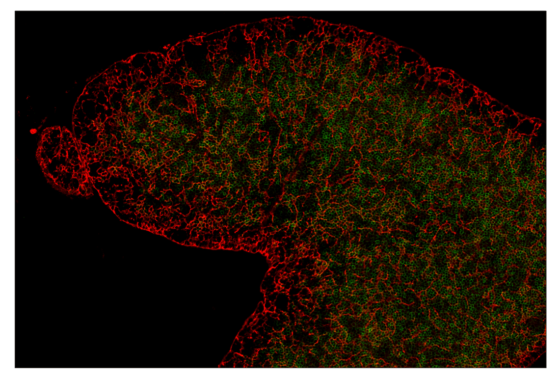 Immunohistochemistry Image 7: E-Cadherin (24E10) & CO-0103-647 SignalStar<sup>™</sup> Oligo-Antibody Pair