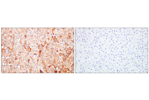 Immunohistochemistry Image 7: DHFR (E6L1H) Rabbit Monoclonal Antibody