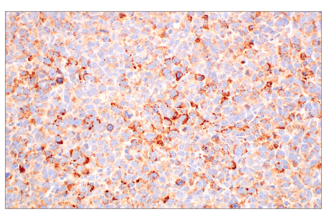 Immunohistochemistry Image 8: GOT2 (F4P3R) Rabbit Monoclonal Antibody
