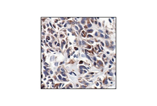 Immunohistochemistry Image 4: NF-kappaB2 p100/p52 (18D10) Rabbit Monoclonal Antibody (BSA and Azide Free)